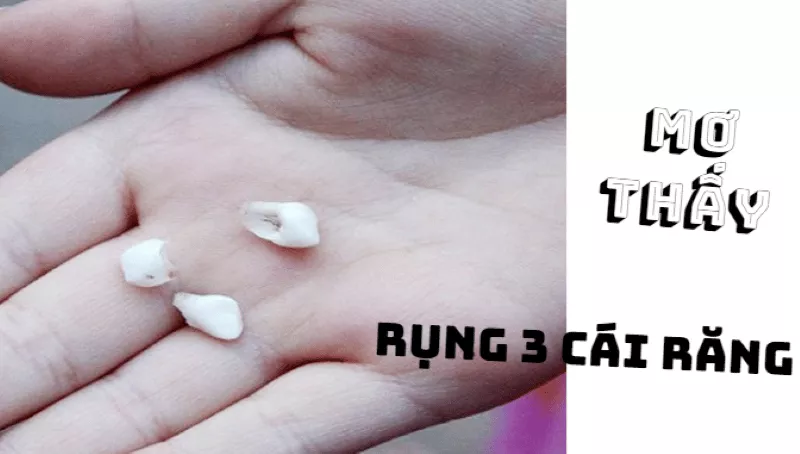 mơ thấy rụng 3 cái răng